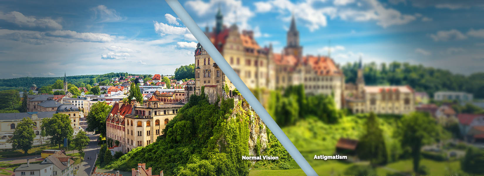 Astigmatism Treatment in Wylie